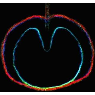 Xtc - Wasp Star (Apple Venus Vol. 2)