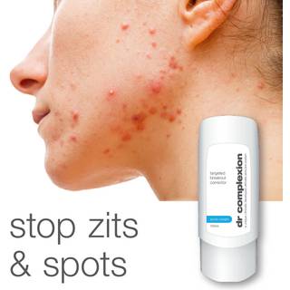 Acne Cream