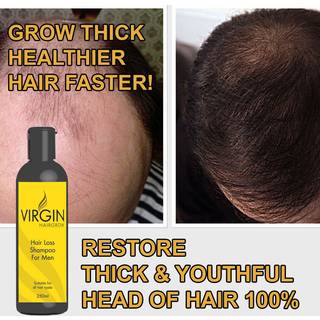 Hairloss Shampoo for Men