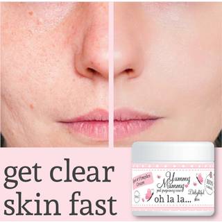 Spot and Pimple Cream