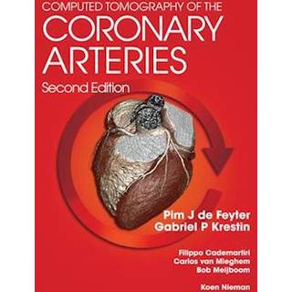Computed Tomography of the Coronary Arteries