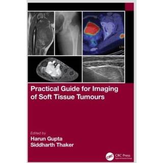 Practical Guide for Imaging of Soft Tissue Tumours