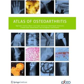 Atlas of Osteoarthritis