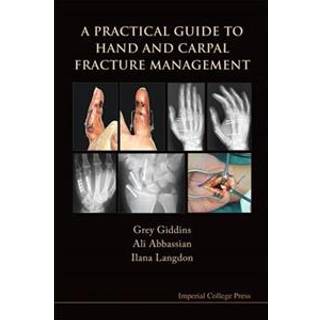 Practical Guide To Hand And Carpal Fracture Management, A
