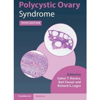 Polycystic Ovary Syndrome