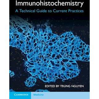 Immunohistochemistry