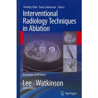 Interventional Radiology Techniques in Ablation