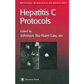 Hepatitis C Protocols