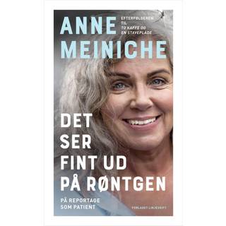 Det ser fint ud på røntgen