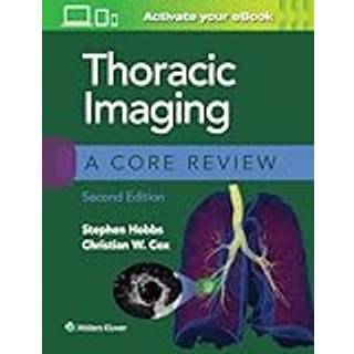 Thoracic Imaging: A Core Review (4, 2020) | Stephen Hobbs,Christian Cox