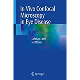 In Vivo Confocal Microscopy in Eye Disease