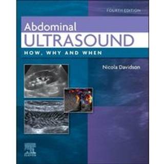 Abdominal Ultrasound
