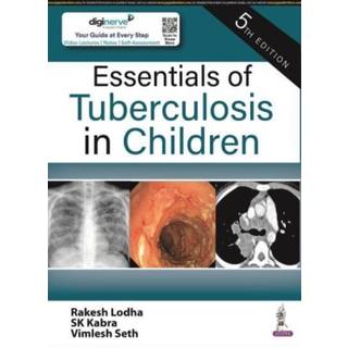 Essentials of Tuberculosis in Children