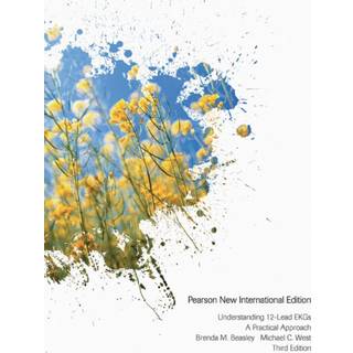 Understanding 12-Lead EKGs
