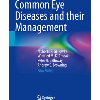 Common Eye Diseases and their Management