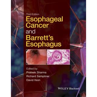 Esophageal Cancer and Barrett's Esophagus