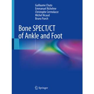 Bone SPECT/CT of Ankle and Foot