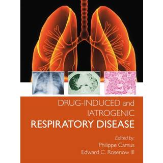Drug-induced and Iatrogenic Respiratory Disease