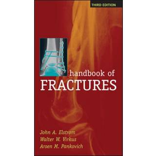 Handbook of Fractures, Third Edition