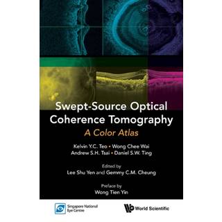 Swept-source Optical Coherence Tomography: A Color Atlas