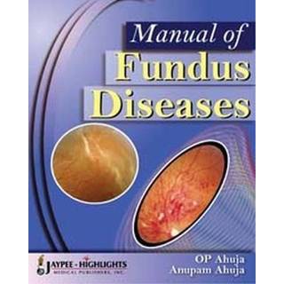 Manual of Fundus Diseases