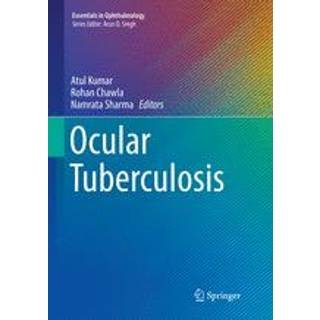 Ocular Tuberculosis