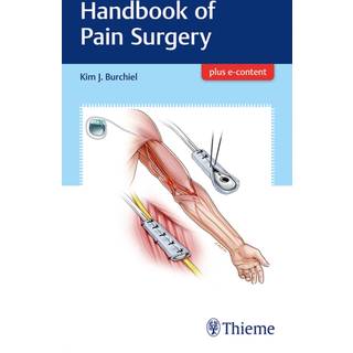 Handbook of Pain Surgery