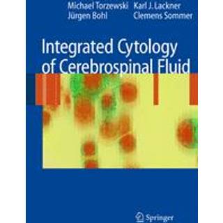 Integrated Cytology of Cerebrospinal Fluid