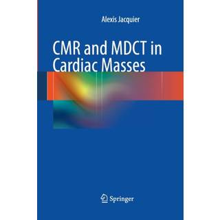 CMR and MDCT in Cardiac Masses