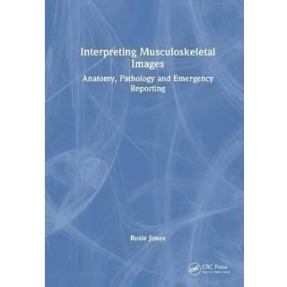 Interpreting Musculoskeletal Images