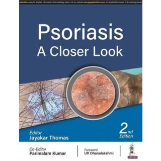 Psoriasis