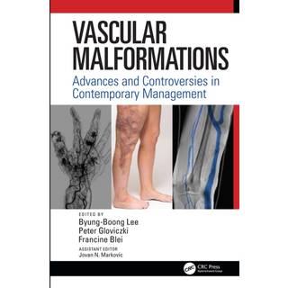 Vascular Malformations