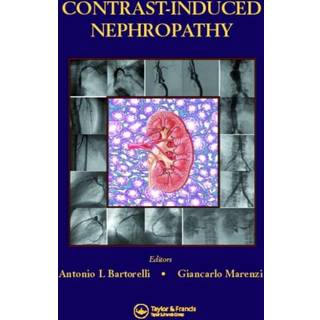 Contrast-Induced Nephropathy in Interventional Cardiovascular Medicine