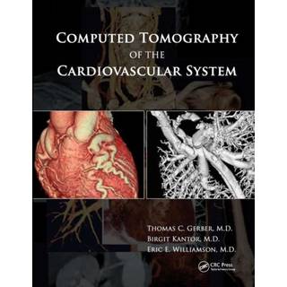 Computed Tomography of the Cardiovascular System
