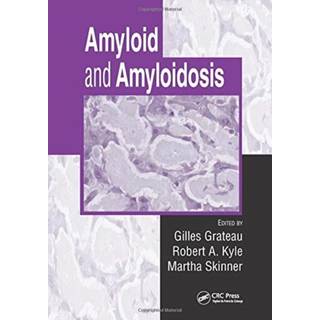 Amyloid and Amyloidosis