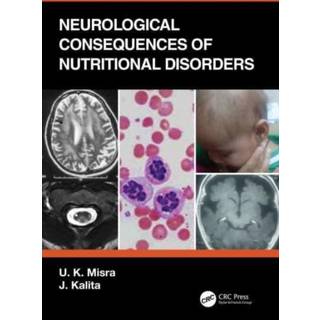 Neurological Consequences of Nutritional Disorders