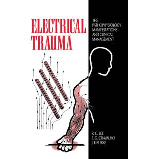 Electrical Trauma