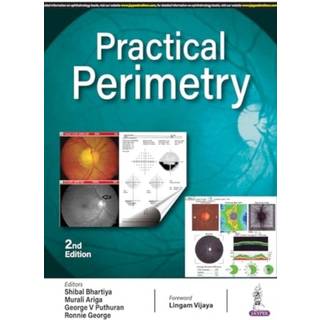 Practical Perimetry