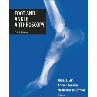 Foot and Ankle Arthroscopy