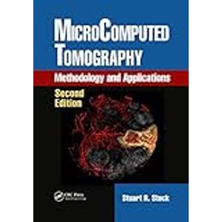 MicroComputed Tomography