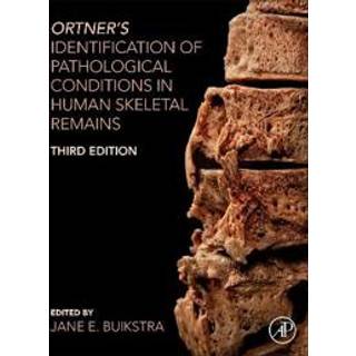 Ortner's Identification of Pathological Conditions in Human Skeletal Remains