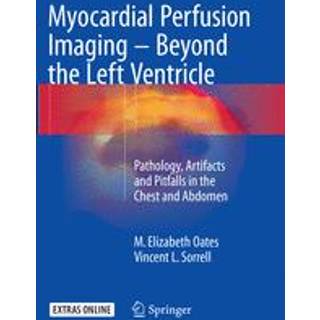Myocardial Perfusion Imaging - Beyond the Left Ventricle