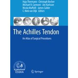 The Achilles Tendon