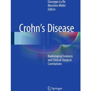 Crohn’s Disease