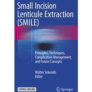 Small Incision Lenticule Extraction (SMILE) (4, 2018) |