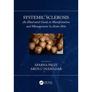 Systemic Sclerosis