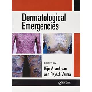 Dermatological Emergencies