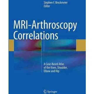 MRI-Arthroscopy Correlations