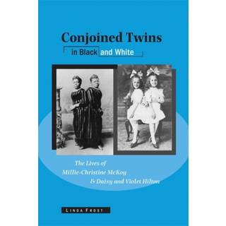 Conjoined Twins in Black and White