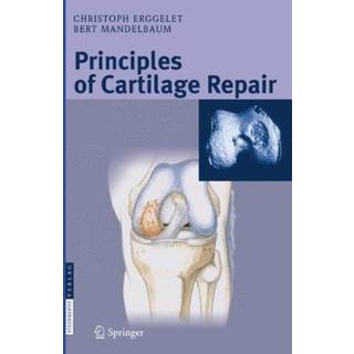 Principles of Cartilage Repair